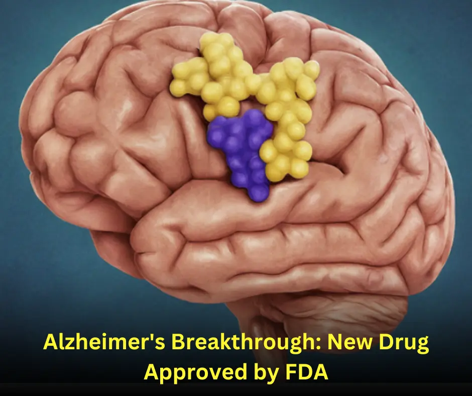 Alzheimer's Breakthrough: New Drug Approved by FDA